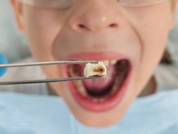 Best Pediatric Emergency Dentist in Snellville, GA
