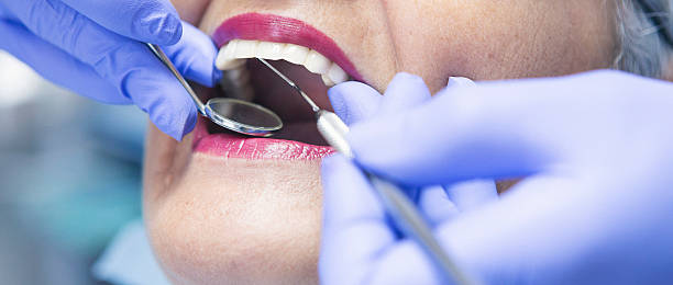 Best Emergency Dental Services for Seniors in Snellville, GA